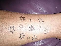 Sussis_star_on_leg